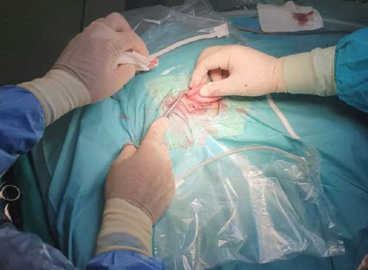 Rádio Regional do Centro: Centro de Implantes Cocleares do CHUC avança com rede nacional