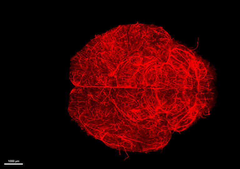 Rádio Regional do Centro: Universidade de Coimbra estuda impacto do sexo biológico no neurodesenvolvimento neonatal